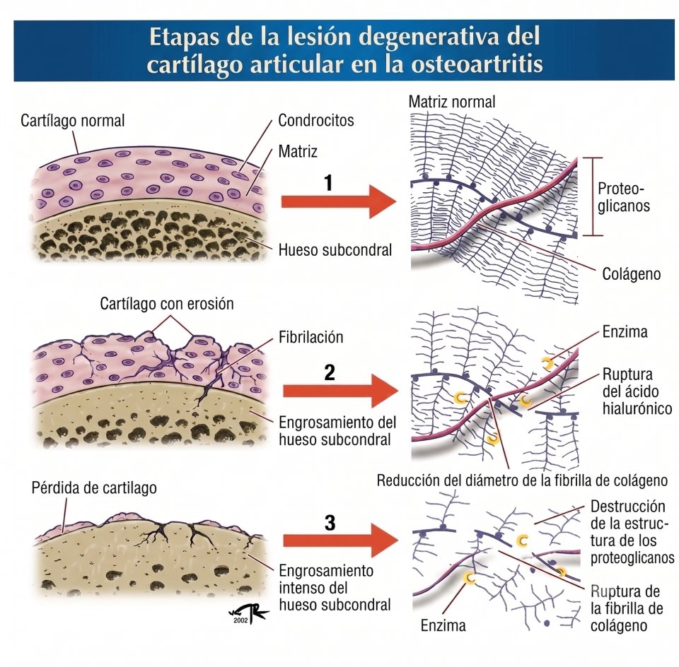 Ciclo fisiopatol&oacute;gico