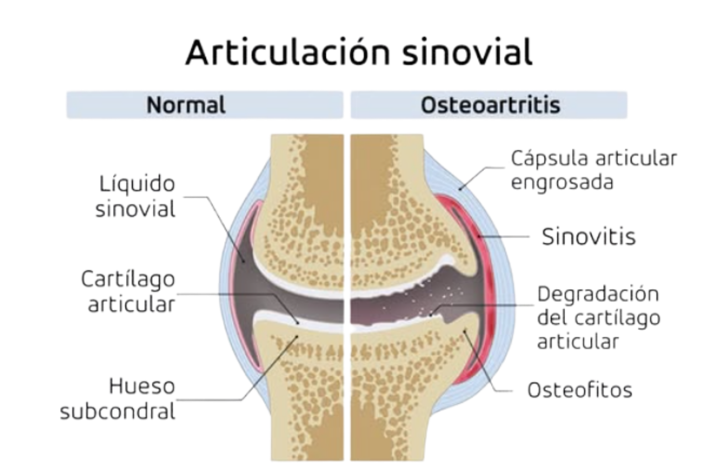 Diagrama de la articulaci&oacute;n